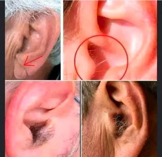 Ear Hair (Hairy Ears): Causes, Meaning & Removal